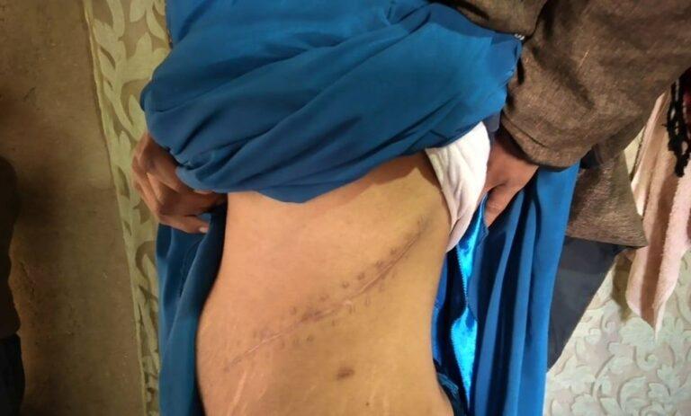 خورۍ ګل: سربېره پر دې چې حامله وم، خپل بډوډی مې وپلوره