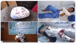 کونړ کې د راکټي بريد له امله ١٦ قاريان او دولتي مامورين ټپيان شوي