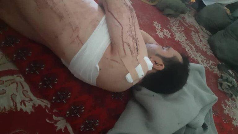   په هرات کې ۱۴ ملکي وګړو ته مرګ ژوبله اوښتې