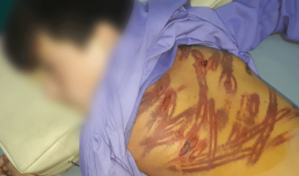 یک کودک ۱۲ ساله در فاریاب مورد ضرب و شتم قرار گرفته است