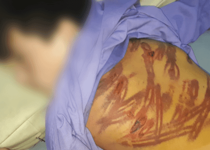 12-year-old boy savagely beaten in Faryab