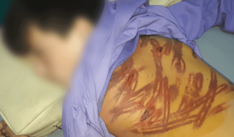 12-year-old boy savagely beaten in Faryab