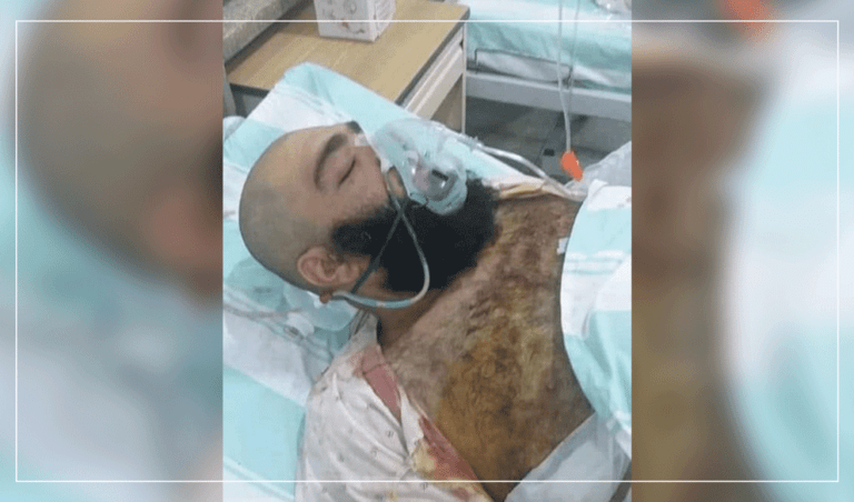 په کندهار ښار کې یو دیني عالم په چړو وهل شوی او ژوبل شوی دی