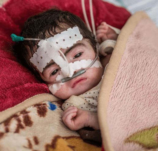 یونیسف از وضعیت کودکان افغان ابراز نا امیدی کرده است