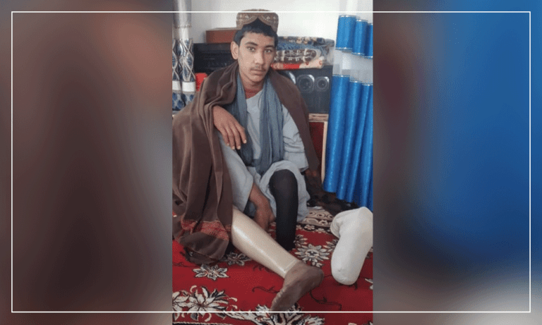 جوانی معلول در فراه: از ختم جنگ در کشور خرسندم، اما کاش صحتمند می‌بودم
