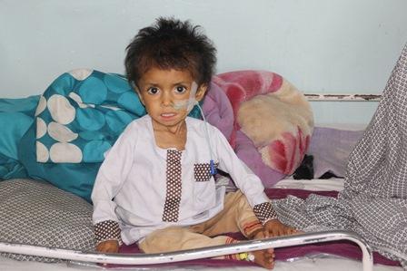 75 children die of malnutrition in Kandahar this year