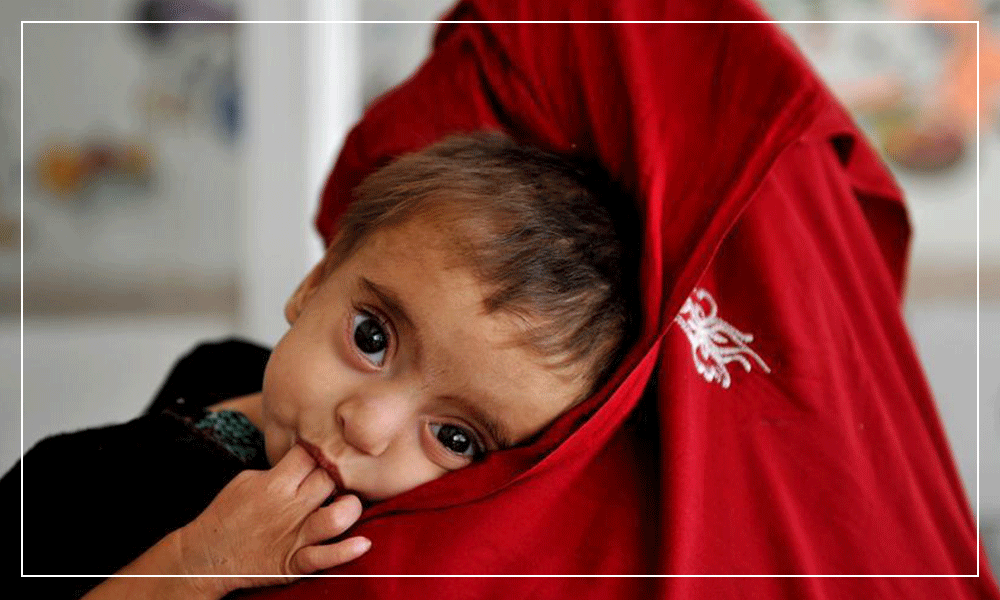یونیسف ۴۵۷ هزار کودک سوء‌تغذی را در جریان یک سال گذشته درمان کرده‌است
