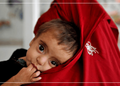 با انجماد دارایی‌های افغانستان، شمار کودکان مبتلا به سوءتغذیه در حال افزایش است