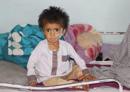 75 children die of malnutrition in Kandahar this year