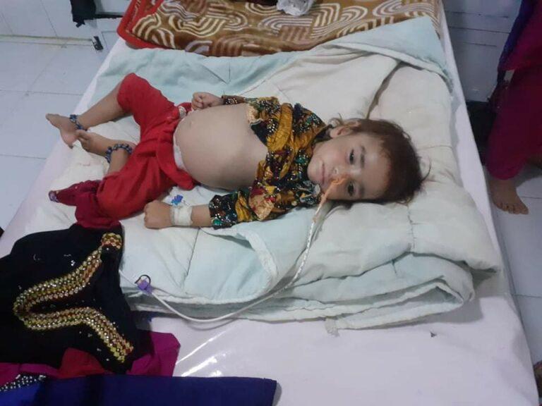 رئیس صحت پنجشیر: ۶۶۳۳ کودک طی یک سال گذشته در این ولایت به سوءتغذیه مبتلا شده‌اند