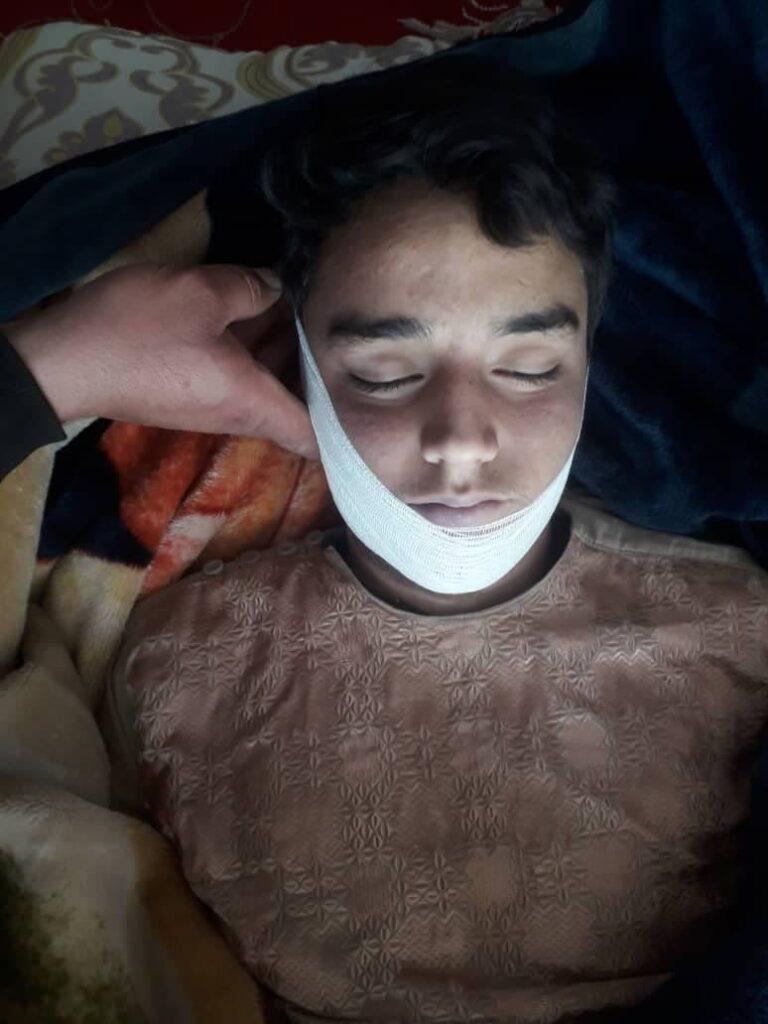 یک نو جوان ۱۶ ساله در غور خودکشی کرد