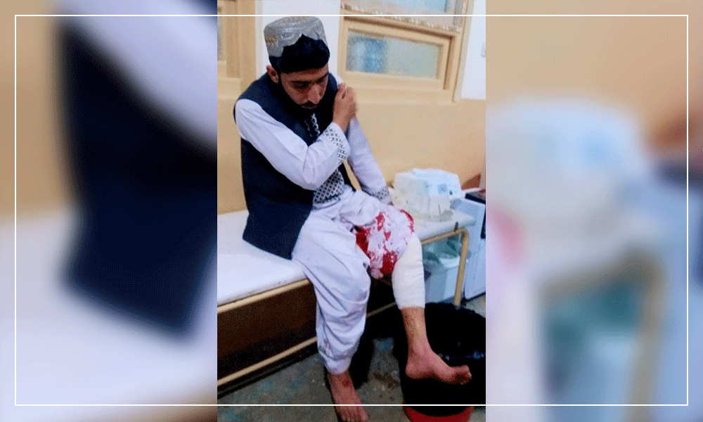 Security forces mistakenly injure teachers, student