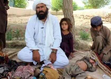 After Pajhwok report, many assist father of malnourished children