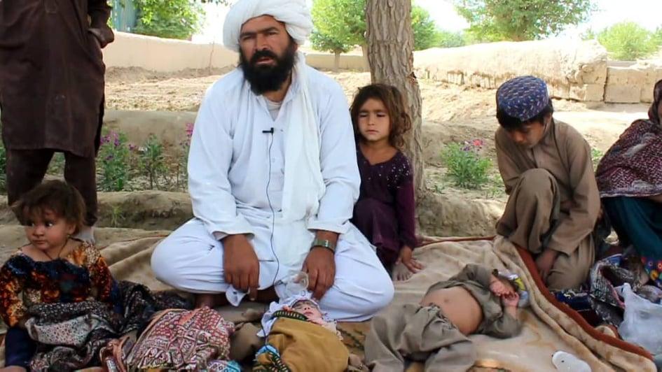Father of Helmand children suffering from malnutrition appeals for help