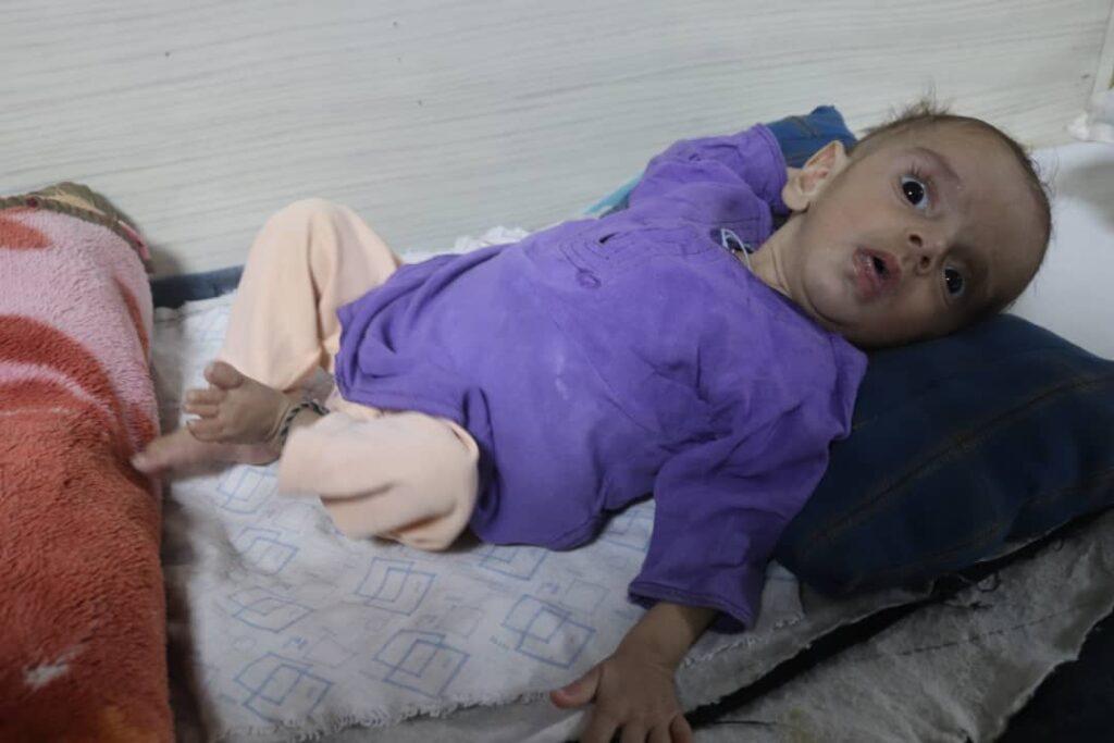 Number of malnourished children on rise in Helmand
