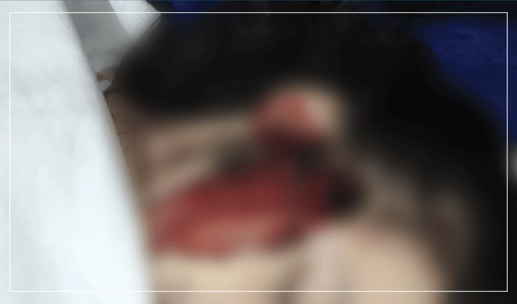 یک دختر ۱۷ ساله در ولسوالی دشت قلعه تخار دست به خودکشی زد