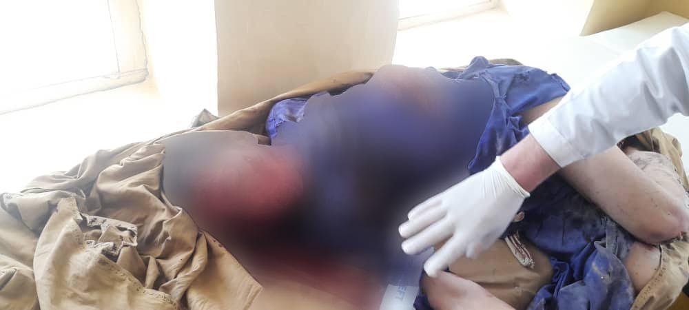 اروزګان کې چاودنې یو ماشوم ټپي کړی