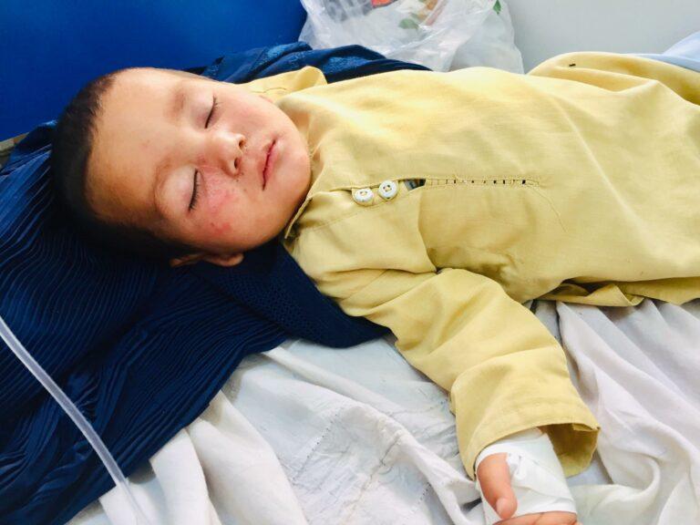 MSF: Measles cases have surged in Afghanistan