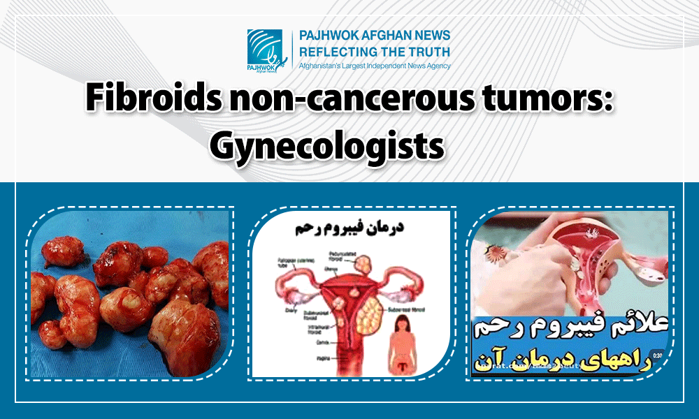 Fibroids non-cancerous tumors: Gynecologists