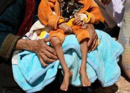 Hundreds of children suffer from malnutrition in Badakhshan
