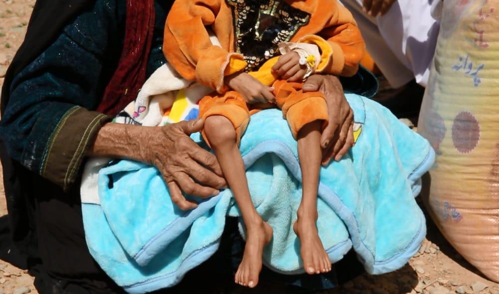 Hundreds of children suffer from malnutrition in Badakhshan