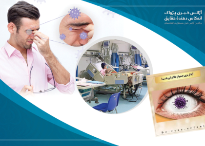 Red eyes may indicate omicron infection: Health experts