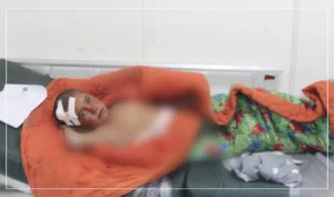 در اثر انفجار یک سرگلولۀ منفجرناشده در زابل چهار تن مجروح گردیده‌اند