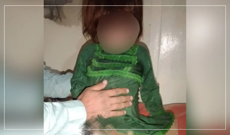 1 child killed, 2 wounded in Paktika explosion