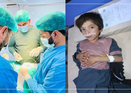 Helmand physician conducts free of cost cleft lip operations 