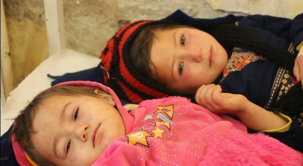 46 children die from measles in Kunduz in 10 months