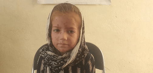  ۱۳ مورد مشکوک بیماری آبلۀ مرغان در پنجشیر ثبت شد