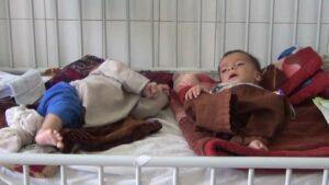 مسؤولین: در دوازده ماه گذشته ۴۲۰ کودک مصاب به سوء‌تغذیه در هرات جان باخته‌اند