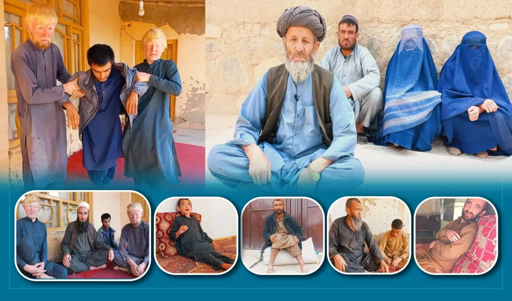 Takhar’s Kalafghan residents suffer from genetic illnesses