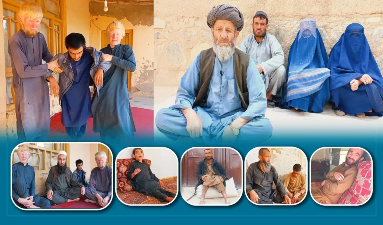 د تخار په کلفګان کې د سرقروق سیمې لسګونه اوسېدونکي له جنټیکي ناروغیو ځورېږي