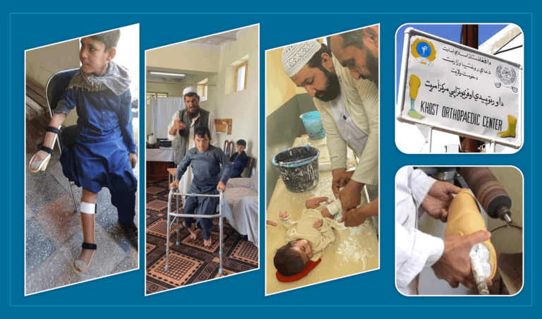 یو شمېر خلک: د خوست اورتوپیدي او فزیوتراپي مرکز کې دې ښځینه کارکوونکې وګومارل شي