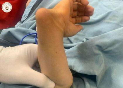 Congenital limb deformity surgery performed successfully: MoD