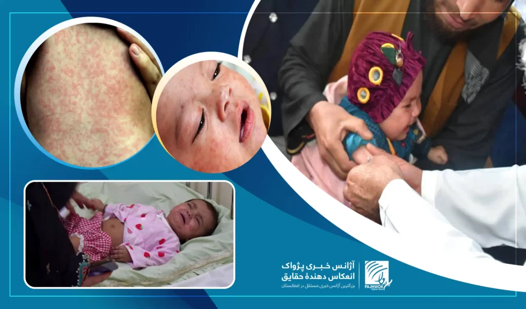 داکتران: سرخکان بیماری ساری است، کودکان را در برابر آن واکسین کنید 