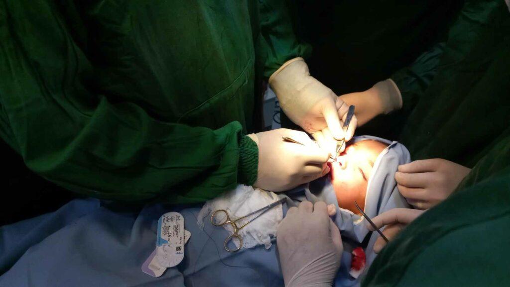 Takhar cleft lip and palate children get free of cost treatment