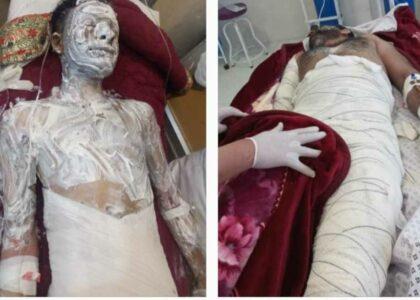 1 killed, 3 wounded in Kandahar drug lab fire