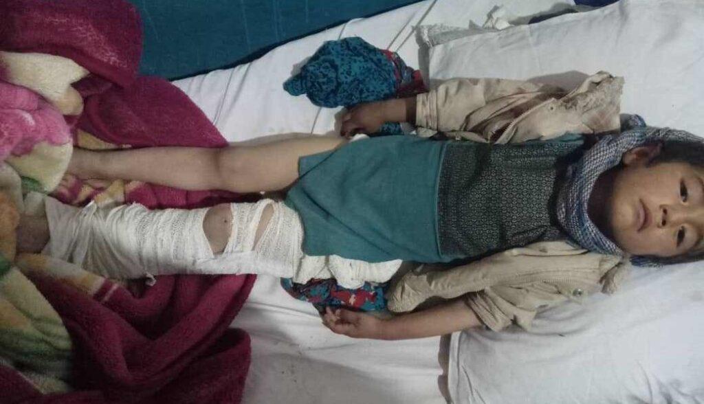 لغزش سنگ در دایکندی جان یک کودک را گرفت و یک زخمی بر جا گذاشت
