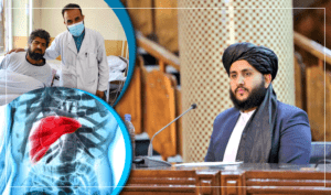 افغانستان کې د تور او سپین زیړي ناروغۍ پېښې دوه برابره شوې دي