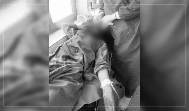 کندهار کې یوه کس د خپل زوم دواړه سترګې ایستلې