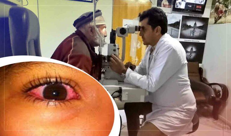 Kabul residents complain contagious eye infection