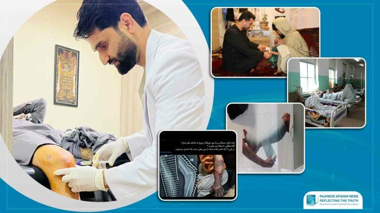 Traditional bone setting dangerous, say doctors
