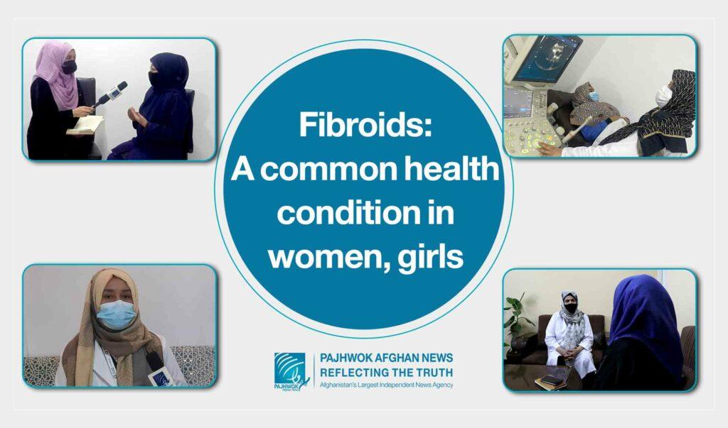 Uterine fibroid awareness key to female wellbeing