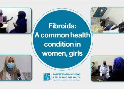 Uterine fibroid awareness key to female wellbeing