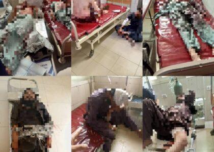 1 killed, 7 wounded over property dispute in Nangarhar