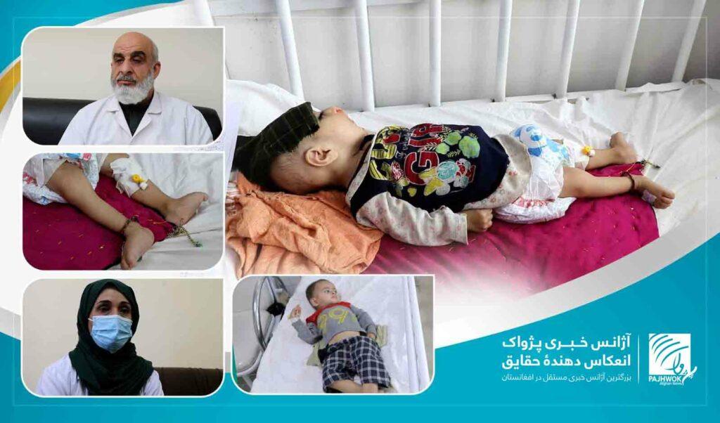 سوءتغذیه در مادران و کودکان؛ تهدید جدی برای سلامت نسل آینده