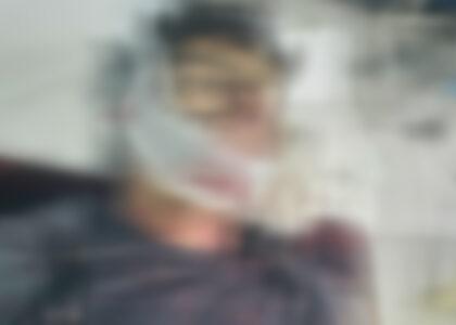 Man killed, 2 others wounded in Kapisa clash