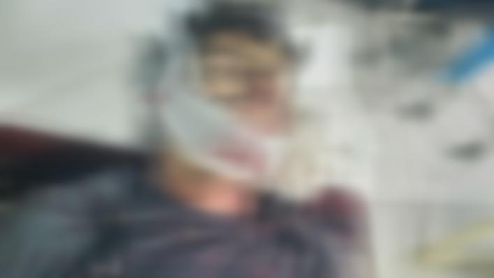 کاپیسا کې یوه کس د ځمکې پر سر شخړه کې خپل ورور وژلی